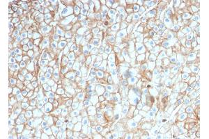 ABIN6383847 to PD-L1 was successfully used to stain membranes of carcinomas in human lung, cervex and breast sections. (PD-L1 antibody  (Extracellular Domain))
