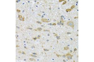 Immunohistochemistry of paraffin-embedded mouse spinal cord using CCT4 antibody. (CCT4 antibody  (AA 130-390))
