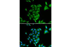 Immunofluorescence analysis of U2OS cells using PHYH antibody (ABIN5973726). (PHYH antibody)