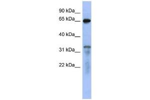 RAP1GAP antibody used at 1 ug/ml to detect target protein. (RAP1GAP antibody  (Middle Region))