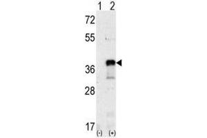 Image no. 2 for anti-SNAIL (SNAI1) (N-Term) antibody (ABIN357453) (SNAIL antibody  (N-Term))