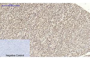Immunohistochemical analysis of paraffin-embedded human uterus tissue. (CDK2 antibody  (AA 200-280))
