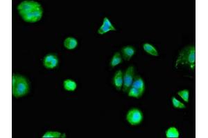 Immunofluorescent analysis of MCF-7 cells using ABIN7153311 at dilution of 1:100 and Alexa Fluor 488-congugated AffiniPure Goat Anti-Rabbit IgG(H+L) (Mesothelin antibody  (AA 1-62))