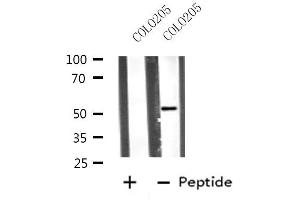 Western blot analysis of extracts from COLO205 cells, using VRK3 antibody.
