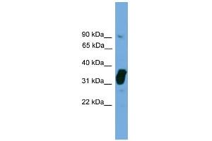 WB Suggested Anti-NOSIP Antibody Titration: 0. (NOSIP antibody  (Middle Region))