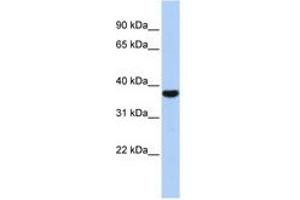 Image no. 1 for anti-Exosome Component 2 (EXOSC2) (AA 143-192) antibody (ABIN6740694) (EXOSC2 antibody  (AA 143-192))