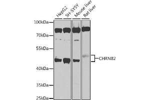 Western blot analysis of extracts of various cell lines, using CHRNB2 antibody (ABIN6131327, ABIN6138590, ABIN6138592 and ABIN6225110) at 1:1000 dilution. (CHRNB2 antibody  (AA 340-430))