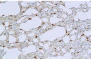 Formalin-fixed and paraffin embedded mouse lung labeled with Anti TMPRSS2 Polyclonal Antibody, Unconjugated  followed by conjugation to the secondary antibody and DAB staining (TMPRSS2 antibody  (AA 301-400))