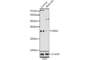 Western blot analysis of extracts from normal (control) and KRAS knockout (KO) 293T cells, using KRAS antibody (ABIN6132168, ABIN6143000, ABIN6143001 and ABIN6216439) at 1:1000 dilution. (K-RAS antibody  (AA 30-188))