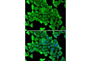 Immunofluorescence analysis of U2OS cells using MYH1 antibody. (MYH1 antibody  (AA 1-100))
