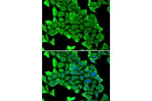 Immunofluorescence analysis of U2OS cells using MYH1 antibody. (MYH1 antibody  (AA 1-100))