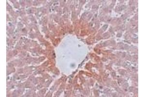 Immunohistochemistry of AGTR2 in rat liver tissue with AGTR2 antibody at 5 μg/ml. (Angiotensin II Type 2 Receptor antibody  (Center))