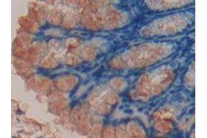 Detection of CCND2 in Mouse Intestine Tissue using Polyclonal Antibody to Cyclin D2 (CCND2) (Cyclin D2 antibody  (AA 47-267))