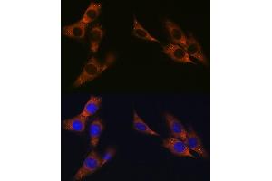 Immunofluorescence analysis of NIH-3T3 cells using γ-Catenin Rabbit mAb (ABIN1683043, ABIN3018625, ABIN3018626 and ABIN7101634) at dilution of 1:100 (40x lens). (JUP antibody)