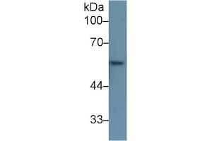 Western Blot; Sample: Rat Skin lysate; Primary Ab: 1µg/ml Rabbit Anti-Human KRT6A Antibody Second Ab: 0. (KRT6A antibody  (AA 163-468))