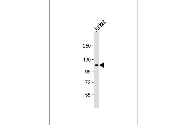 PRDM16 anticorps  (AA 771-804)