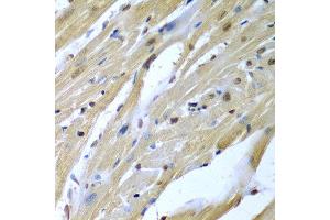 Immunohistochemistry of paraffin-embedded mouse heart using TUSC2 antibody at dilution of 1:200 (40x lens). (TUSC2 antibody)