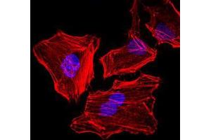 Immunofluorescence analysis of HeLa cells. (Cytokeratin 5 antibody)