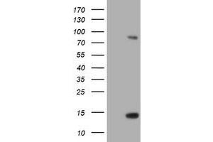 Image no. 1 for anti-Spastic Paraplegia 7 (SPG7) (AA 300-573) antibody (ABIN1491374)
