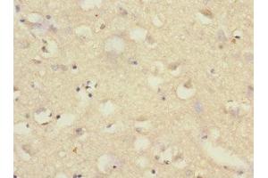 Immunohistochemistry of paraffin-embedded human brain tissue using ABIN7170966 at dilution of 1:100 (SAE1 antibody  (AA 1-346))
