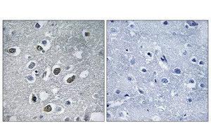 Immunohistochemistry (IHC) image for anti-Membrane-Associated Ring Finger (C3HC4) 4, E3 Ubiquitin Protein Ligase (MARCH4) (C-Term) antibody (ABIN1851268)