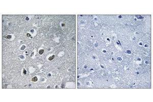 Immunohistochemistry (IHC) image for anti-Membrane-Associated Ring Finger (C3HC4) 4, E3 Ubiquitin Protein Ligase (MARCH4) (C-Term) antibody (ABIN1851269) (MARCH4 antibody  (C-Term))