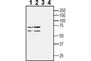 Western blot analysis of human  retinal cell epithelium cell line lysate (lanes 1 and 3) and Malme-3M melanoma cell line lysate (lanes 2 and 4):1-2.