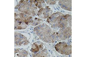 Immunohistochemistry of paraffin-embedded human stomach using APP antibody. (beta Amyloid antibody)