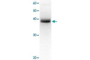 Detection of XPA protein in crude extract of HeLa cell by western blotting, using XPA monoclonal antibody, clone 5F12 . (XPA antibody)
