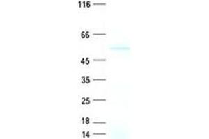 Validation with Western Blot (CPN1 Protein (His tag))