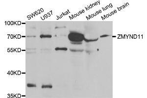 Western blot analysis of extracts of various cell lines, using ZMYND11 antibody.