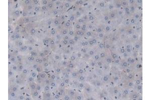 Detection of F2 in Rat Liver Tissue using Monoclonal Antibody to Coagulation Factor II (F2) (Prothrombin antibody  (AA 201-323))