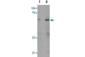 Western blot analysis of human skeletal muscle tissue with RANBP10 polyclonal antibody  at (Lane 1) 1 and (Lane 2) 2 ug/mL dilution. (RANBP10 antibody  (Internal Region))