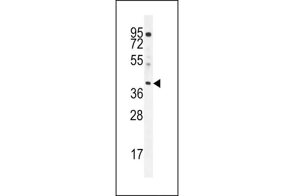 ELMOD2 antibody  (C-Term)