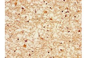 IHC image of ABIN7152369 diluted at 1:300 and staining in paraffin-embedded human brain tissue performed on a Leica BondTM system. (Ezrin antibody  (AA 1-251))