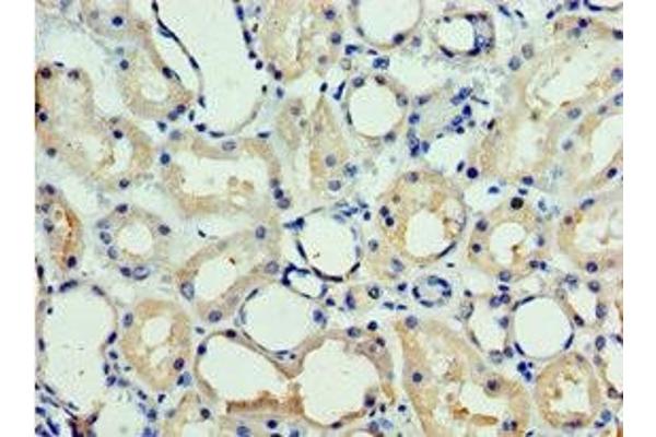 CHD2 antibody  (AA 1569-1828)