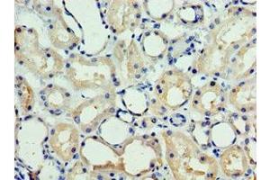 Immunohistochemistry of paraffin-embedded human kidney tissue using ABIN7147719 at dilution of 1:100 (CHD2 antibody  (AA 1569-1828))