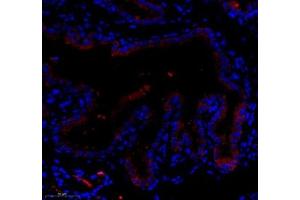Immunofluorescence of paraffin embedded mouse placenta using LTF (ABIN7074457) at dilution of 1: 700 (300x lens) (Lactoferrin antibody)