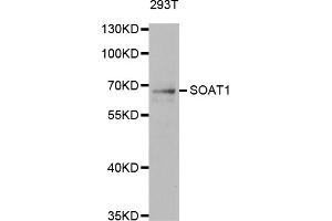 Western blot analysis of extracts of 293T cells, using SOAT1 antibody.