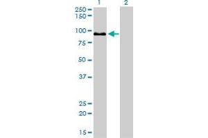 Western Blot analysis of ZW10 expression in transfected 293T cell line by ZW10 monoclonal antibody (M05), clone 2E5. (ZW10 antibody  (AA 1-100))