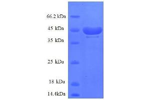Ribosomal Protein S14 (RPS14) (AA 2-146), (partial) protein (GST tag)
