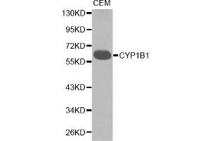 Western blot analysis of extracts of CEM cell lines, using CYP1B1 antibody. (CYP1B1 antibody)