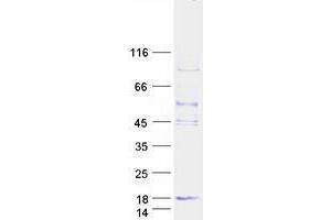 Validation with Western Blot (TYROBP Protein (Transcript Variant 1) (Myc-DYKDDDDK Tag))