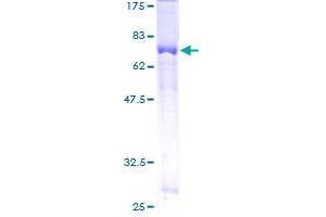 TRIP13 Protein (AA 1-432) (GST tag)