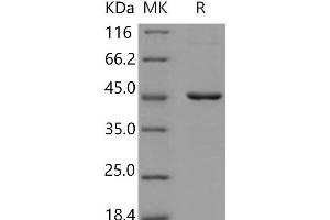 Western Blotting (WB) image for Histone Deacetylase 8 (HDAC8) protein (His tag) (ABIN7320338) (HDAC8 Protein (His tag))