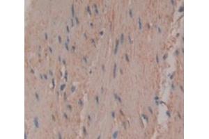 Figure. (TNNT3A antibody  (AA 147-269))