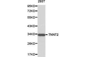 Western Blotting (WB) image for anti-Cardiac Troponin T (cTnT) antibody (ABIN1875151) (Cardiac Troponin T2 antibody)