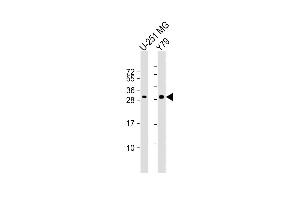 All lanes : Anti-PK1IP1L Antibody (Center) at 1:1000 dilution Lane 1: U-251 MG whole cell lysate Lane 2: Y79 whole cell lysate Lysates/proteins at 20 μg per lane. (MAPK1IP1L antibody  (AA 108-137))