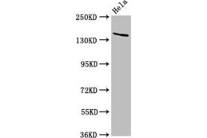 Western Blot Positive WB detected in: Hela whole cell lysate All lanes: LAMC2 antibody at 5 μg/mL Secondary Goat polyclonal to rabbit IgG at 1/50000 dilution Predicted band size: 131, 122 kDa Observed band size: 140 kDa (LAMC2 antibody  (AA 417-588))