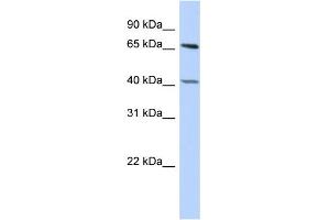 WB Suggested Anti-RBBP5 Antibody Titration:  0. (RBBP5 antibody  (Middle Region))